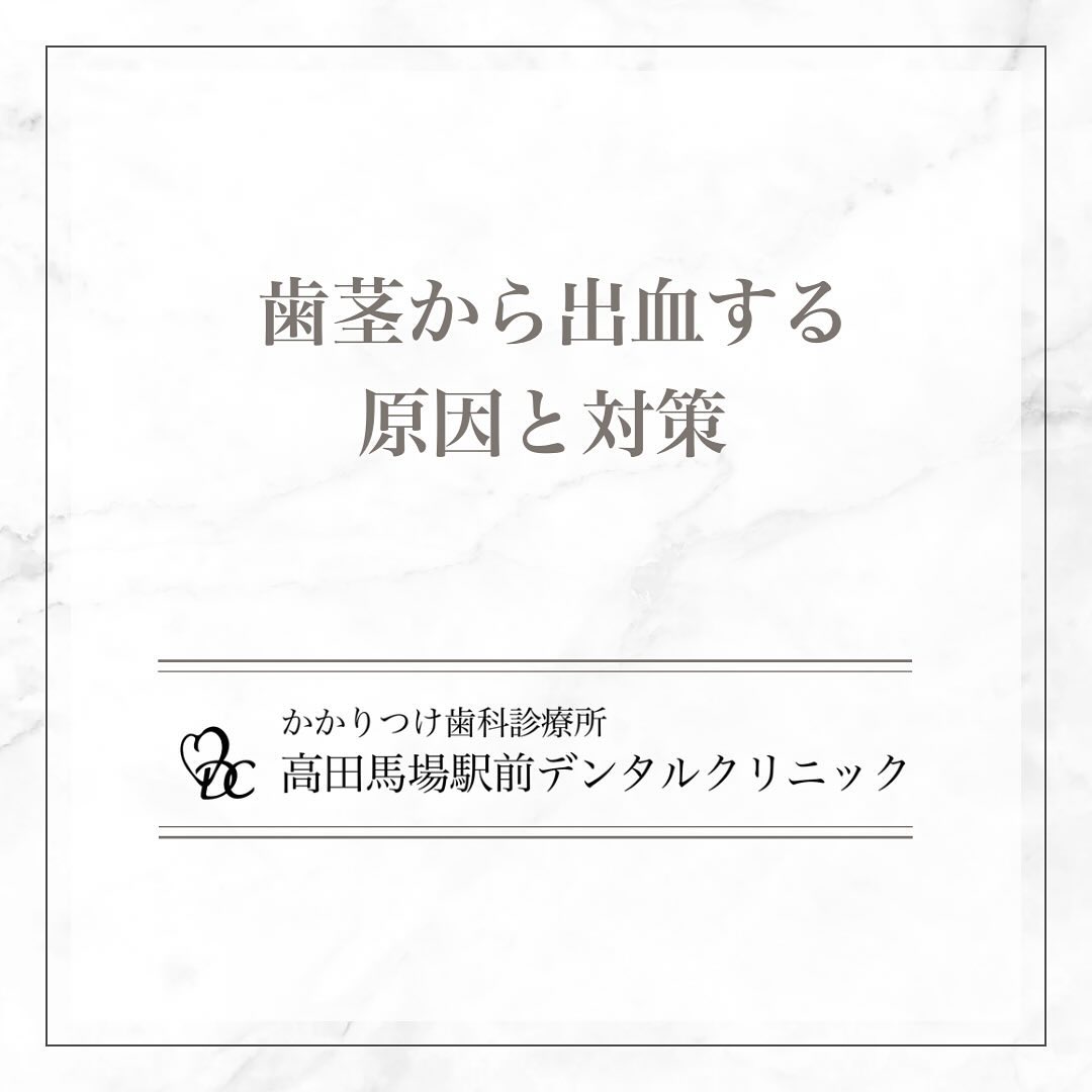 こんにちは！高田馬場駅前デンタルクリニックです。本日の投稿では、 歯茎から出血する原因と対策 についてお知らせいたします。1️⃣ 歯茎から出血する原因出血の原因は歯周病が原因の場合が多いです。早めの対処が重要です。2️⃣ 歯肉の状態をしっかり把握するには出血は歯肉に炎症がある重大なサインです。早めに歯科の受信をお勧めいたします。3️⃣ 正しいブラッシング法歯周病の対策で大切なのがご自身での歯磨きです。歯科を受診し、正しいブラッシングを身につけましょう。4️⃣ 歯科での定期メインテナンス定期的な歯科医院での受診で口腔内全体の健康を保ちましょう。お気軽に当院までご相談ください。美しい笑顔と健康な歯を手に入れましょう🦷お問い合わせやご予約はお気軽にどうぞ️高田馬場駅前デンタルクリニック〒169-0075東京都新宿区高田馬場2丁目16-2 1F03-6380-2467#高田馬場 #歯医者 #高田馬場歯医者 #インプラント #虫歯 #審美歯科 #デンタルクリニック #一般歯科 #矯正歯科 #口腔外科 #歯周病 #歯茎からの出血